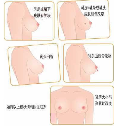 乳房异常情况